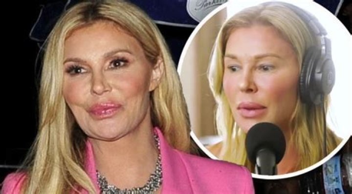 Brandi Glanville Facelift And Lip Augmentation – Plastic Surgery Age And Family Details