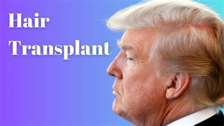 Donald Trump literally put his hair on the line to win WrestleMania