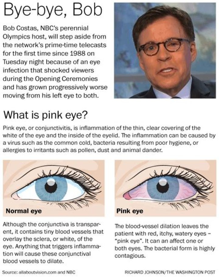 Everyone is Wondering about the Bob Costas Eye Infection