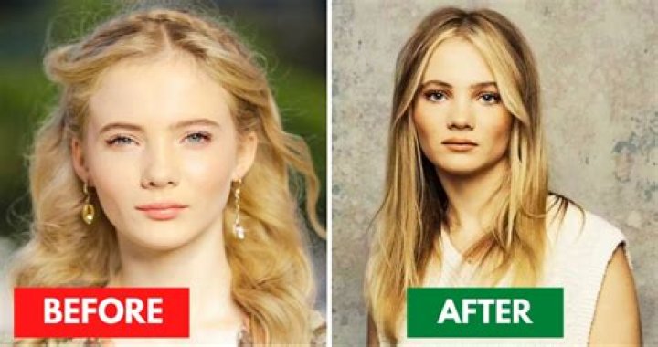 Freya Allan Botox: Fans Suspect Lip Filler And Nose Job