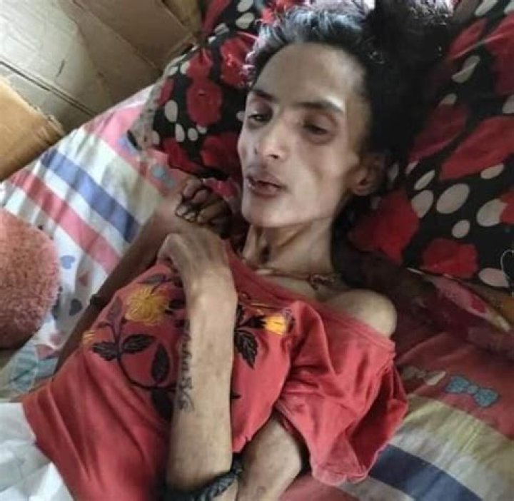 Nisha Ghimire Accident Injury: Illness And Health At Death
