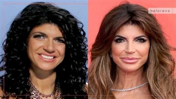 Teresa Giudice Nose Job, Plastic Surgery Before And After